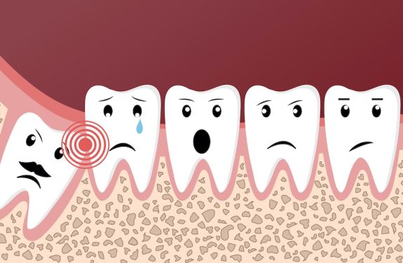 Wisdom teeth dental problems funny concept